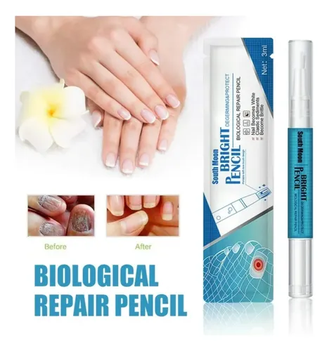 Kit Uña Hongo Severo + Lápiz Reparador + Crema Antimicótico Blanco