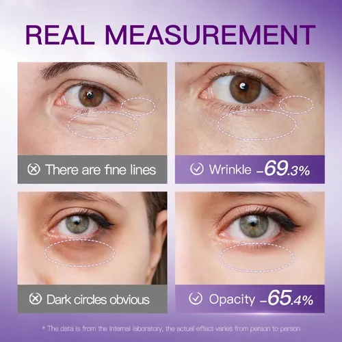 Parches Para Ojos Colágeno Liofilizado Bolsas Y Ojeras