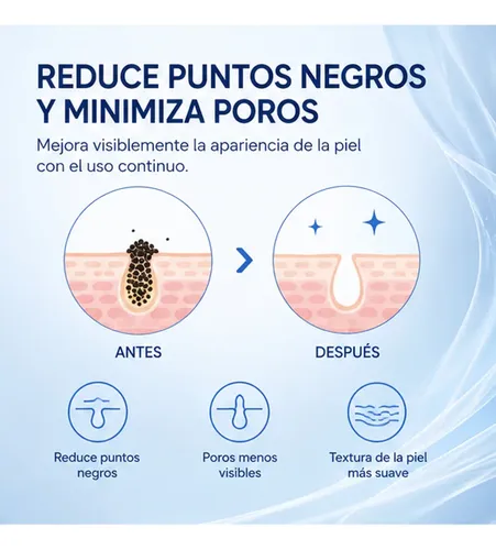 Mascarilla Limpiadora De Puntos Negros Oil-control 100 G Grasa