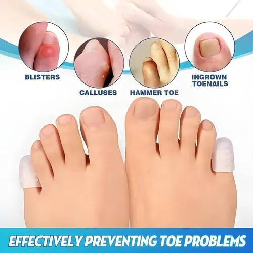 40 Piezas Silicona Anti-fricción Protector Dedo Longzhou