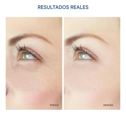 6 Parche Oculares De Microagujas Los Ojos Debajo Las Ojera
