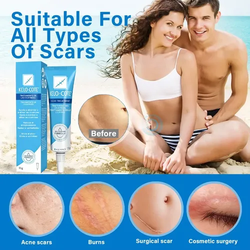Crema En Gel Reparadora Para Queloides, Acné, Quemaduras Y C