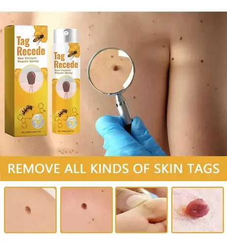 A 6pcs Tag Recede Bee,tag Recede Bee Spray For Mujeres Y