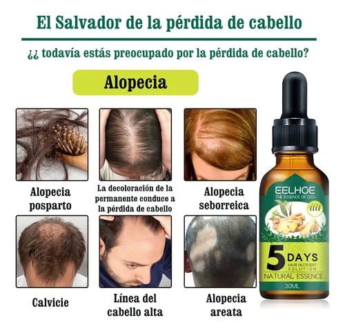 Aceite Capilar Jengibre Anticaída Nutritivo