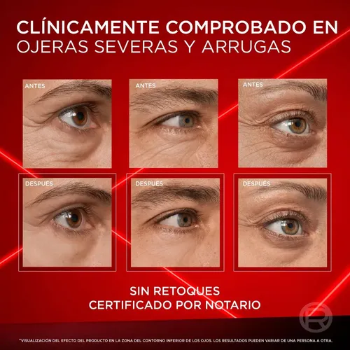 Contorno de Ojos Revitalift Laser L´Oreal Paris 15ml