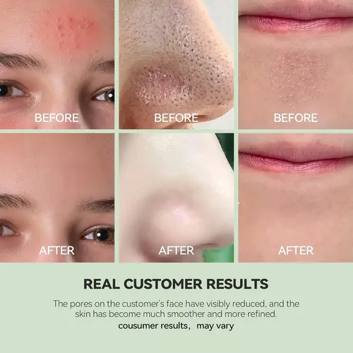 Mascarilla Limpiadora De Arcilla Wnp Duo Con Niacinamida Y Á
