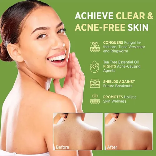 Jabón De Árbol De Té, Piel Sana, Exfoliante Suave