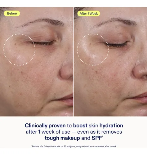 Gel Suave Limpiador Skinfix Ceramide + Ectoin, 45 Ml, Vegano