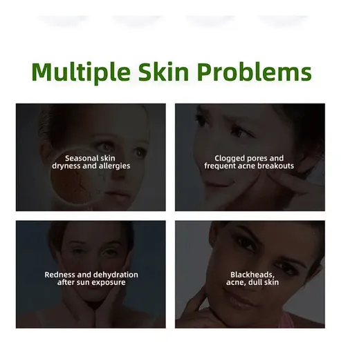 Gel Hidratante De Aloe E Hidratante Para Después De La Repar