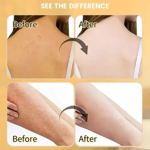 Exfoliante Corporal De Colágeno Con Vitamina C 2026 New