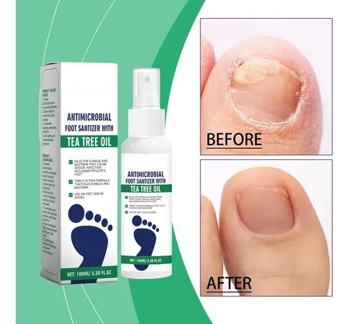 H Spray Para Pies Antitranspirante Y Antiolor – 100 Ml