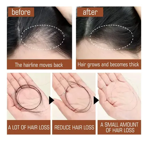 Aceite De Batana Para El Crecimiento Del Cabello, Cabello As