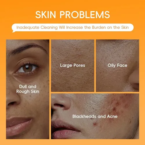 Máscara De Arcilla Con Vitamina C, Máscara Facial De Arcilla