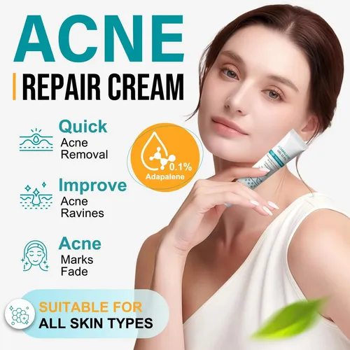 $crema Facial Antiacné 20 G, Hidratante, Reduce Los Granos D