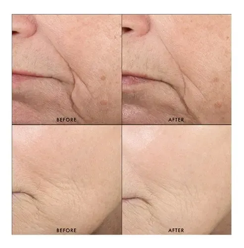 Skinceuticals – Triple Lipid Restore 2:4:2 Antiedad | 48 Ml Tipo De Piel Todo Tipo De Piel