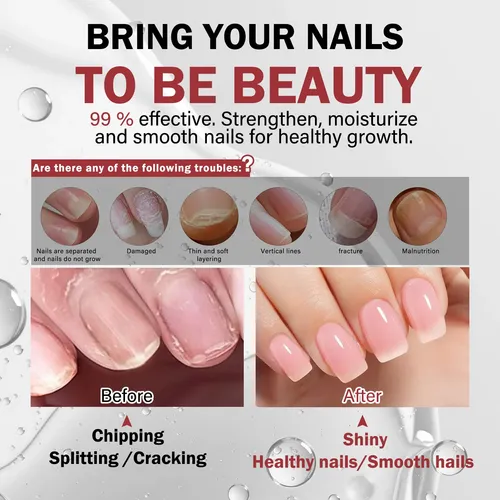 Base Tratamiento Uñas 12ml Niveladora Crecimiento Endurecedo