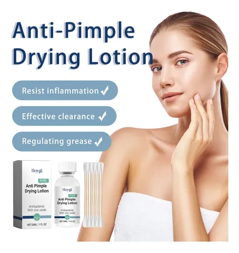Crema Para Manchas De Acné Hoygi Para Rostro, Decoloración D