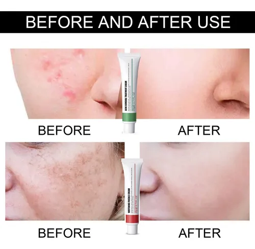 A5080301 Pmcrema Desvanecedora De Manchas Y Pecas Facial