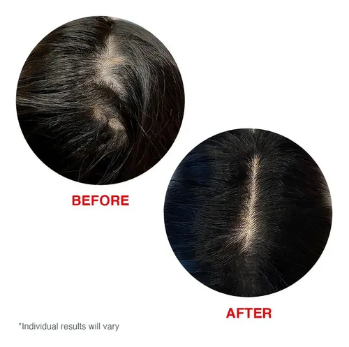 Suero De Recuperacion Capilar Hairtamin Scalp Serum Sfs Ht7