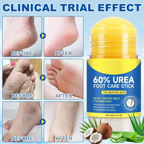 Crema Para Pies Con Urea Al 60%, Hidratante Para Pies Secos Y Agr