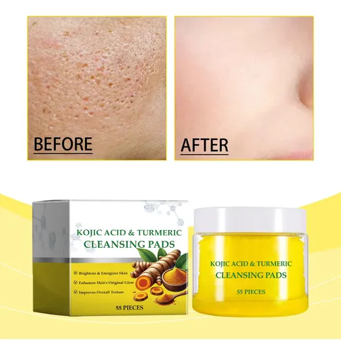 Almohadillas Limpiadoras Faciales – Gentle Facial Acation Co