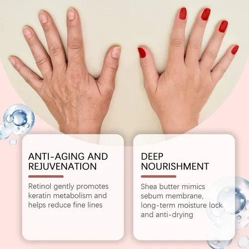 Crema Para Las Manos Con Retinol Antienvejecimiento,