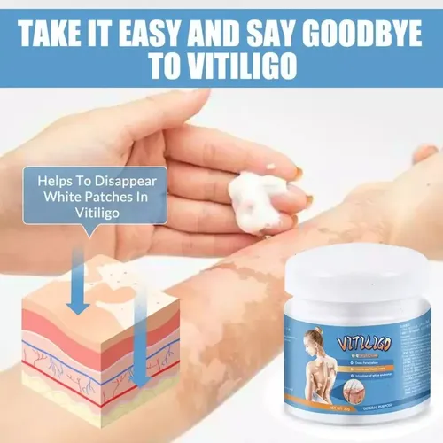 A5080301 Pmpara Crema Para Vitíligo, Elimina Las Manchas