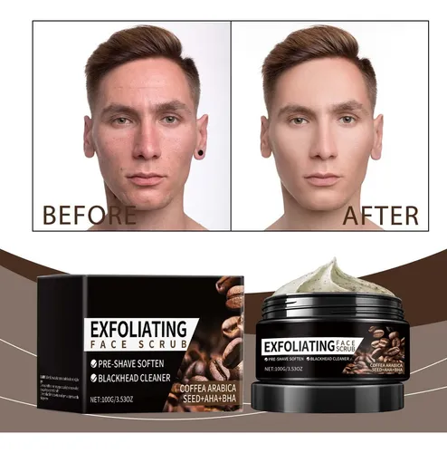 Cy Exfoliante Facial De Café Para Eliminar Puntos Negros Y