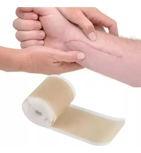 Rollo de Parche de Silicona para Eliminar Cicatrices y Queloides 1.5Mts