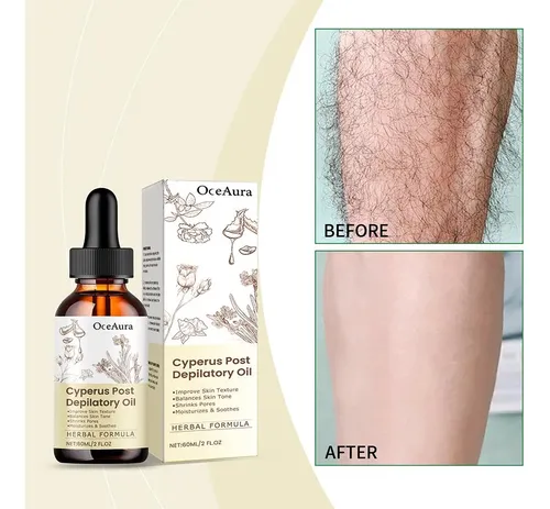 Aceite Postdepilatorio Cyperus 60 Ml | Depilación Natural
