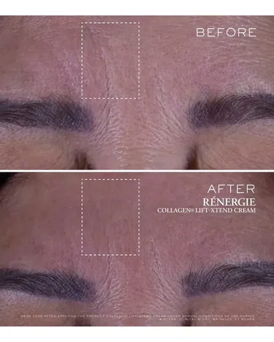 Crema Rénergie Collagen Lift-Xtend 50ml Lancôme