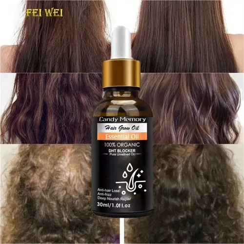 Aceite Capilar Con Extracto De Jengibre (pack De Dos)