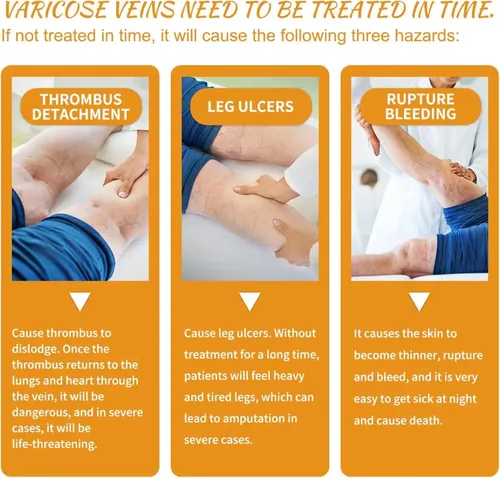 2 Unidades De Crema Milagrosa For Varices Con Vitamina K