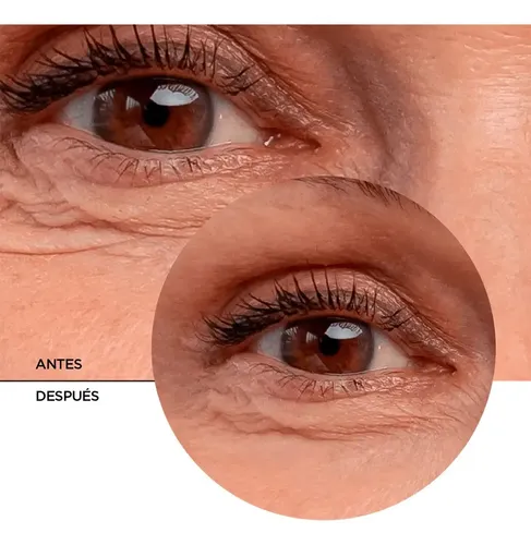 Revox B77 Gel Facial · Retinol Contorno Ojos Bolsas Y Ojeras