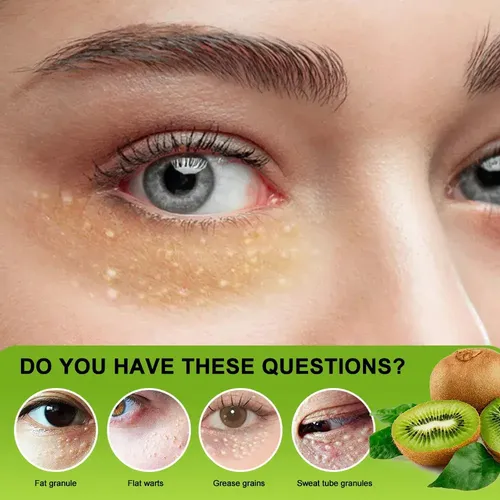 Aacrema Para Ojos Antigránulos, Grasa, Antihinchazónss