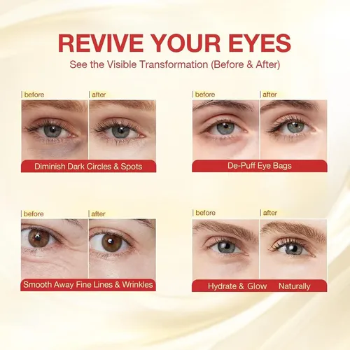 Parche Ojos 360° Gonim Con Pdrn Y Colágeno