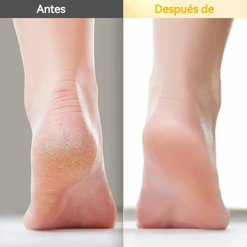 2 Cremas Hidratantes Para Pies Con Un 60% De Urea Y Un 2% De