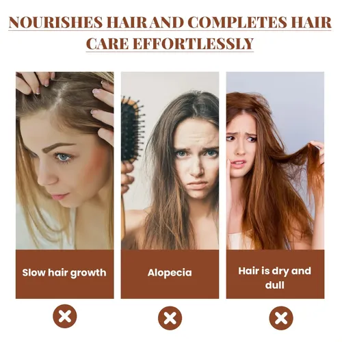 El Aceite Para El Crecimiento Del Cabello Hoegoa Batana Nutr