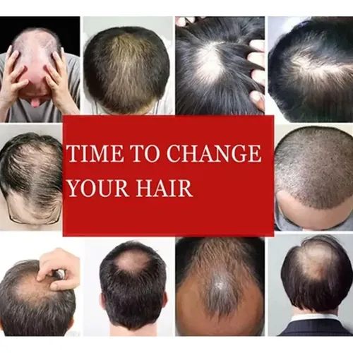 Wssimulación De Peluca Negra Cabello Corto Para Hombreszz