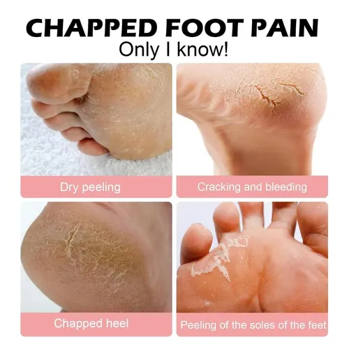 Crema Hidratante Gel Exfoliante Para Pies Y Manos Fd