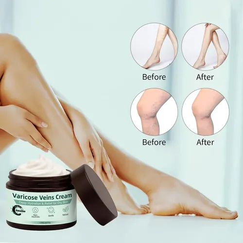 Crema Para Varices Grocerism 1.76 Oz