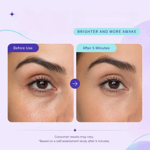 Crema Hidratante For Ojos – Crema Suave E Hidratante For El