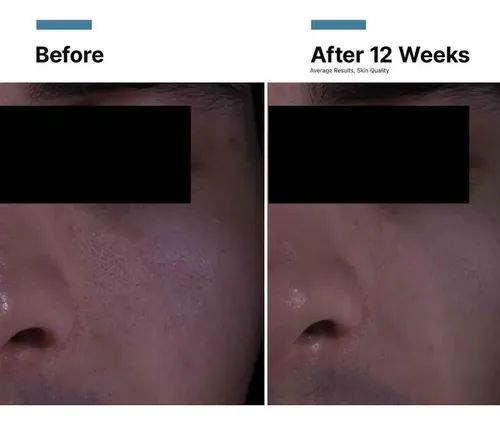 Skinceuticals – P-tiox Anti-wrinkle Cream 48ml Lanzamiento!!