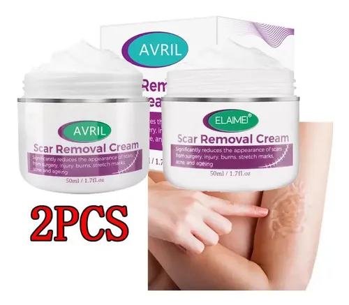 Crema Para Eliminar Cicatrices, Aliviar Estrías Y Quemar