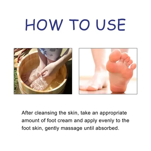 La Crema Para El Cuidado De Los Pies Ximonth Alivia E Hidrat
