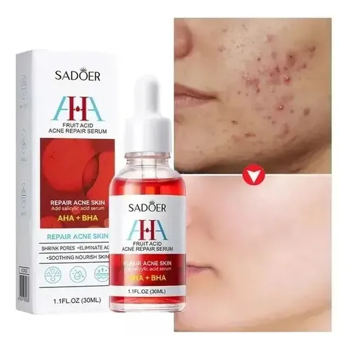 Serum Ácido Salicílico Frutal Reparadora Del Acné Hidratante Tipo De Piel Todo Tipo De Piel