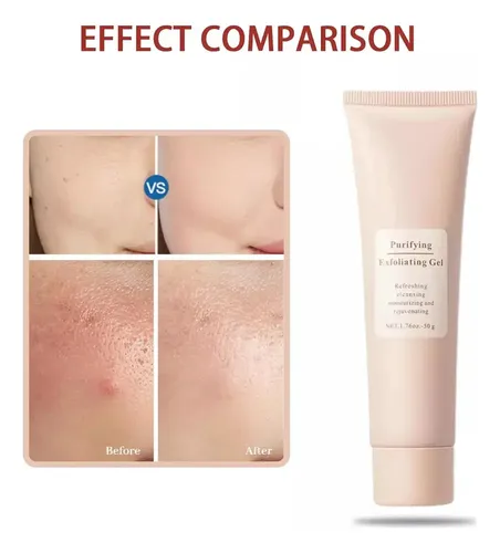 Agel Exfoliante Purificante Jorondy, Gel Exfoliante Jorondy