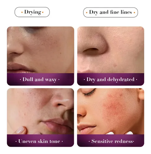 Tónico Hidratante M, Exfoliación Facial, Astringe Los