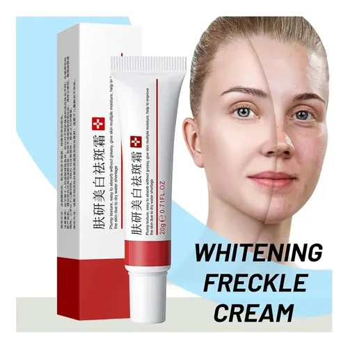 +crema Para Manchas Oscuras En La Cara, Cremas Para Quitar /