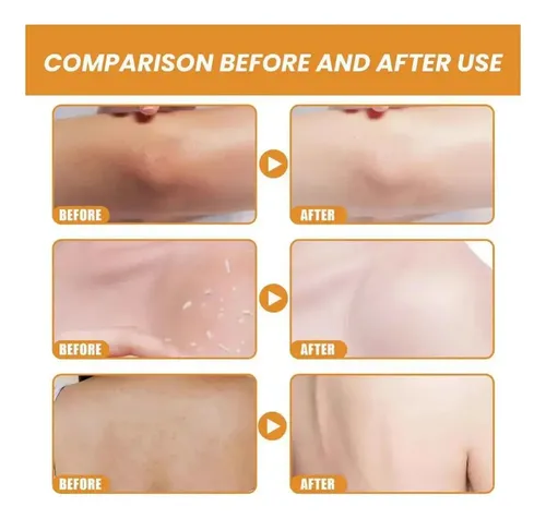 ! Gel Exfoliante C Hidratante De Naranja Para La Piel Y El*
